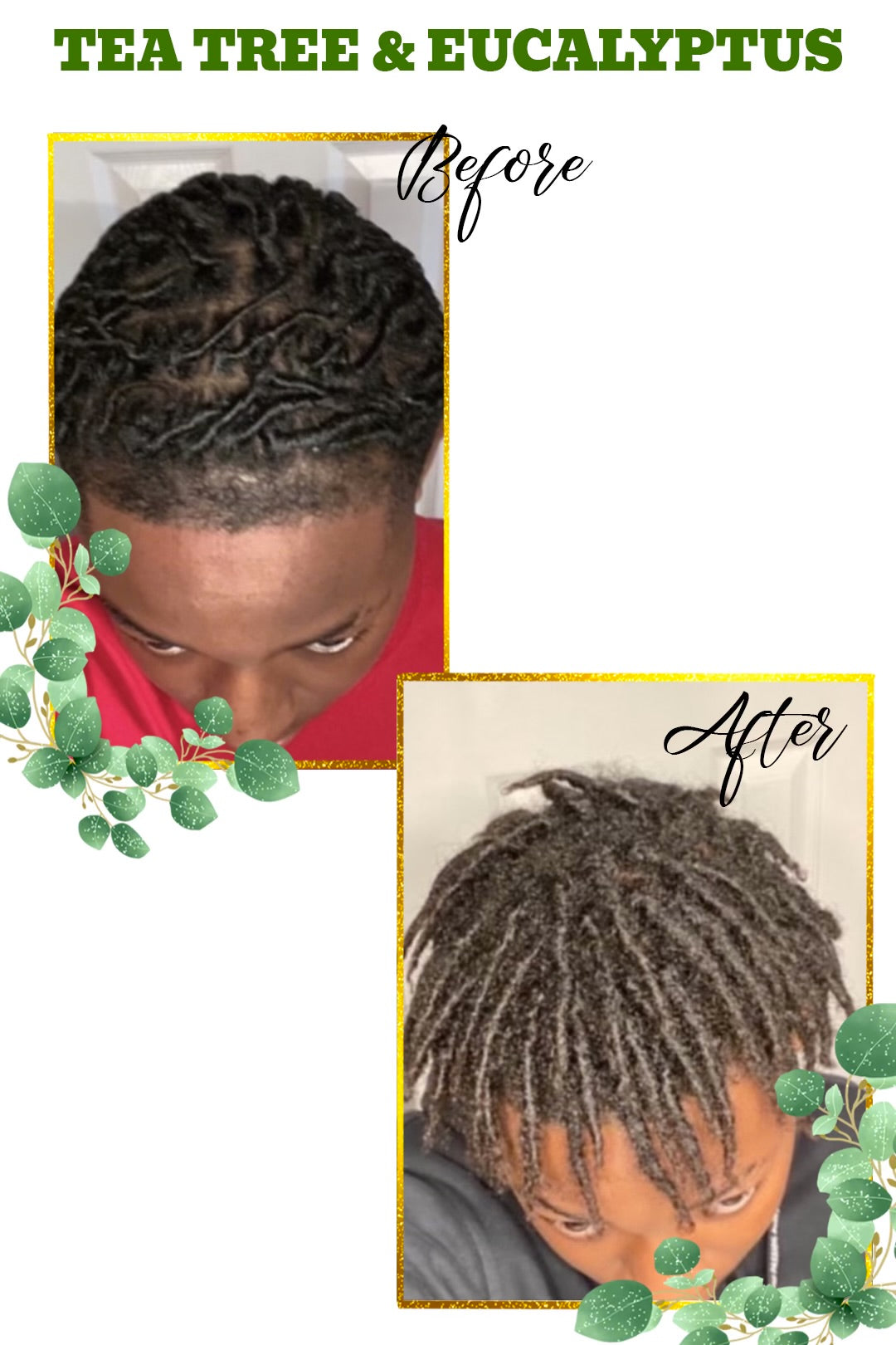 Itchy Scalp Wash Bundle